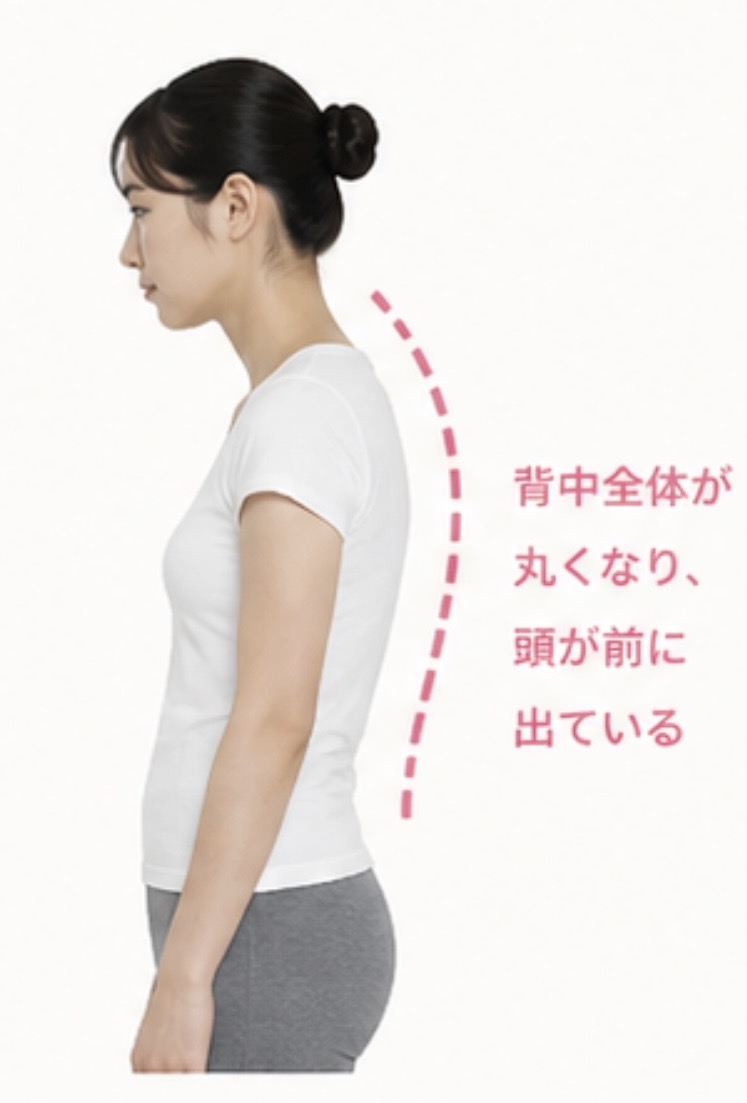 頭猫背